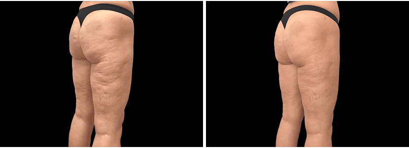 nalgas02